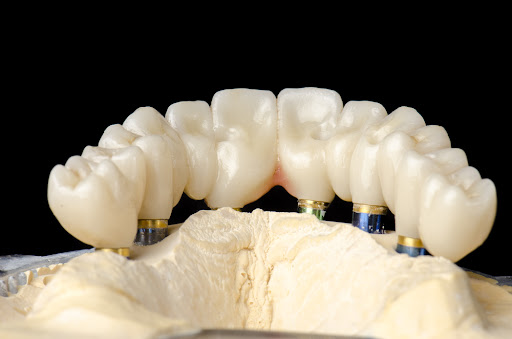 a row of teeth